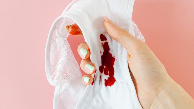 Are Your Period Blood Clots Normal?