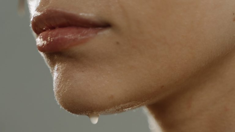 Excessive Sweating — Hyperhidrosis — polyhidrosis or sudorrhea Symptoms, Causes, and Natural Treatment.