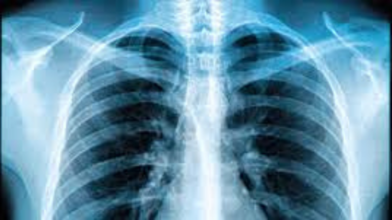 What Are The Effects of X-ray Radiation?