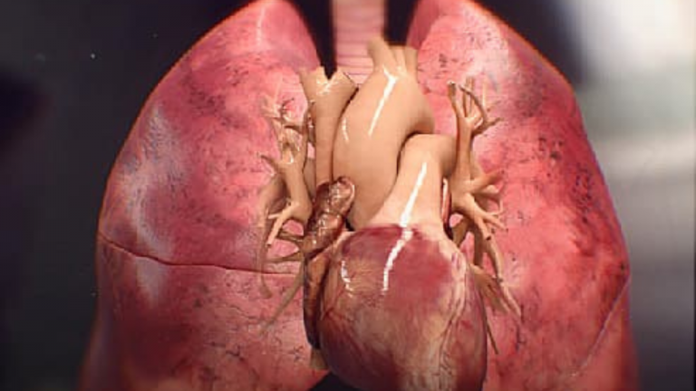 What Are Some Good Foods That Promote Lung Health?
