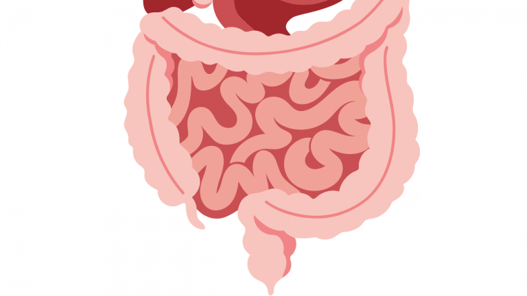 What are Some Foods That Should be Avoided for Gastrointestinal Health?