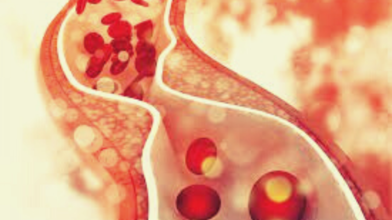 How can I Raise or Balance Low HDL Cholesterol Naturally?