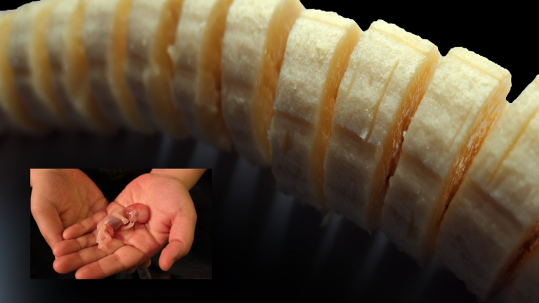 Does Eating Bananas Cause Miscarriage?