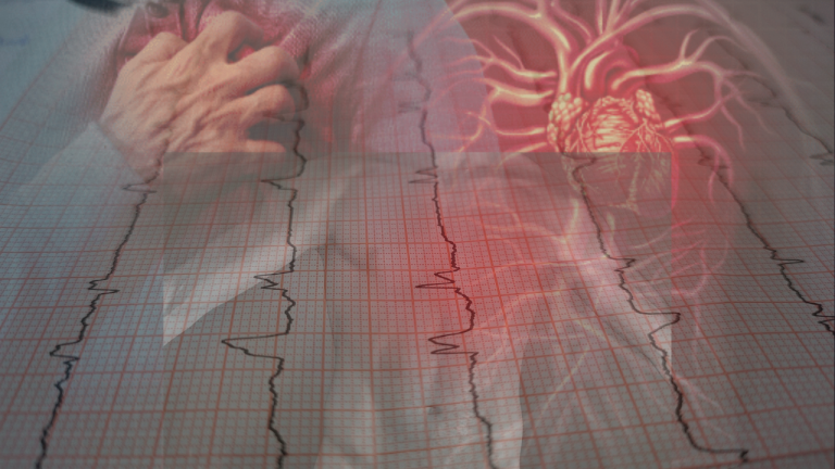 What is your plan/Goal Intervention for Cardiovascular Disease?