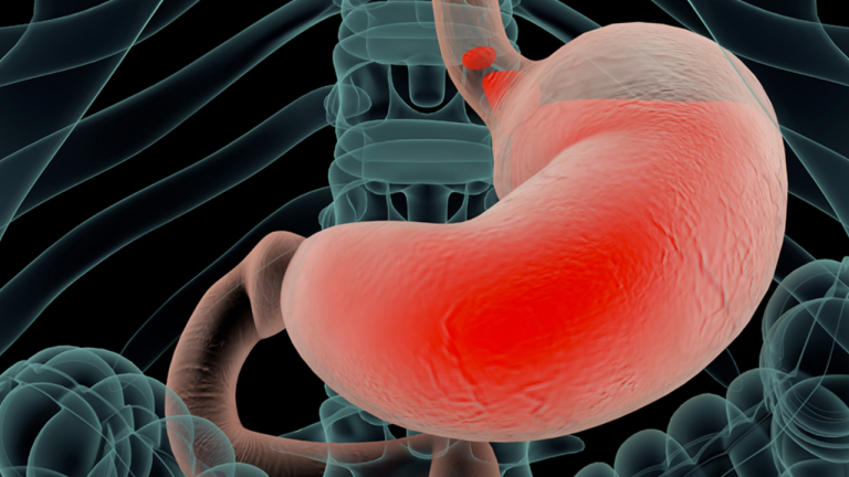 Does stomach Acid pH Affect Someone’s Preference in Food?