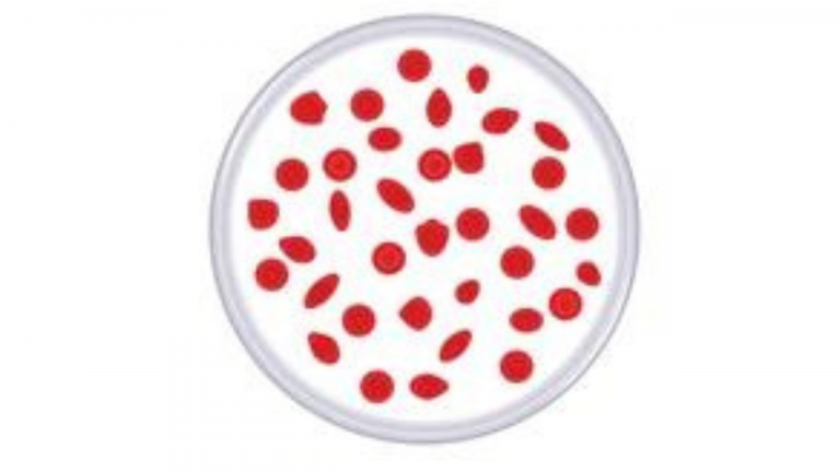 What are some ways for individuals with Thalassemia to Manage their Condition and Improve their Overall Health and Well-Being?