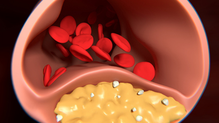 What is Cholesterol? What are it’s Type? What is the Normal Range? What are the Risk Factor of Cholesterol and What are the Complications? What are the Diet that Help to Control the Cholesterol Without Medication?