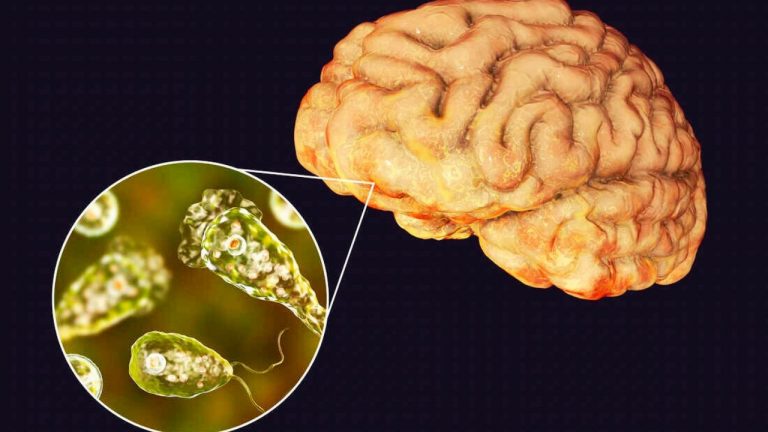 How do I Stop Being Scared of a Brain-Eating Amoeba?