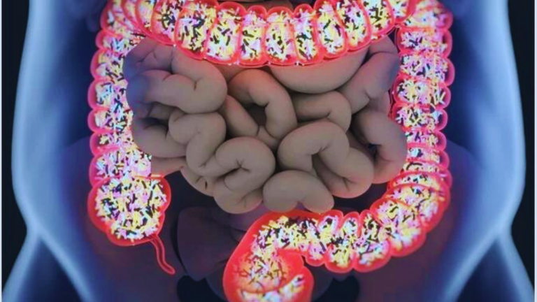 What is the Impact of Diet on Gut Micro biome Diversity, and How Does this Affect Overall Health?