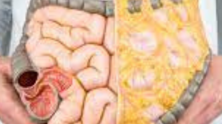 What are Some Tips for Improving your Digestion and Gut Health?