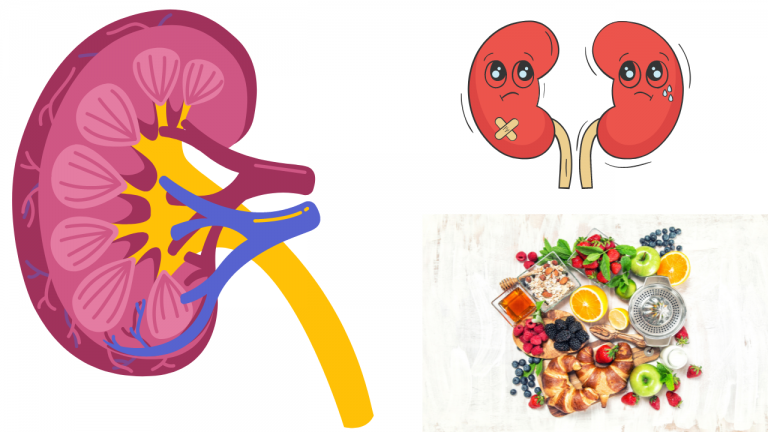 What are the Nutritional Foods that C.K.D. Patients can Take?