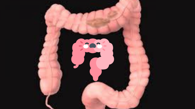 How Can I Solve My IBS?
