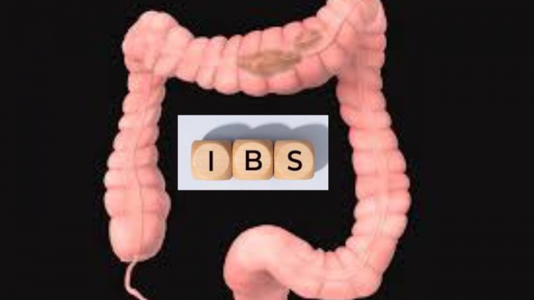 What is a Suggested IBS Diet Food?