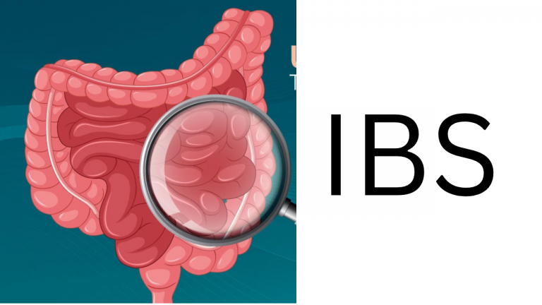 IBS is it permanent?