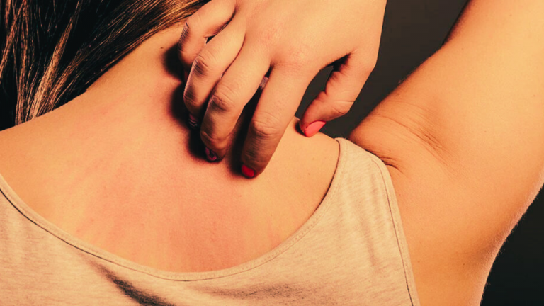 What Causes An Allergy To One’s Own Clothes?