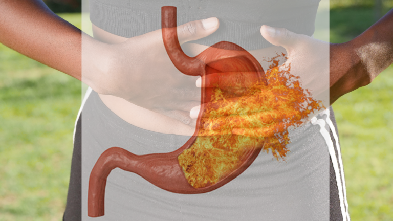 How Can I Reduce Acute Acidity?