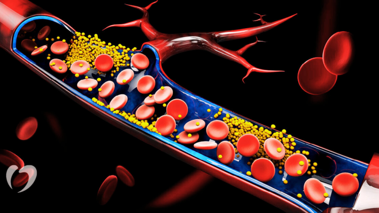 What is the Proper Diet to Reduce Bad Cholesterol?