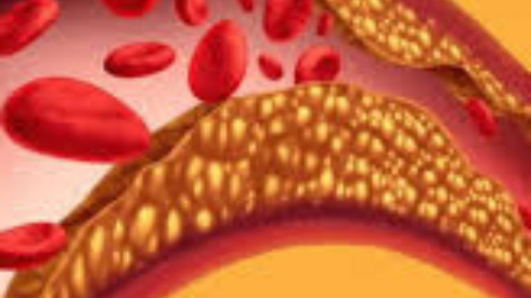 Which Foods Can Increase High Cholesterol Levels?