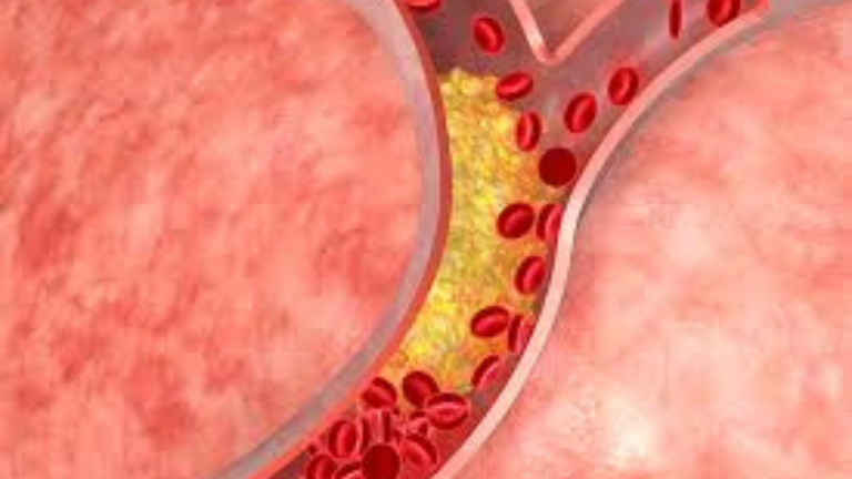 Are There Specific Foods That Can Raise Cholesterol Levels?