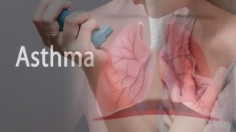 What is Natural Treatment to Get Rid of Asthma Mucus in Lungs?