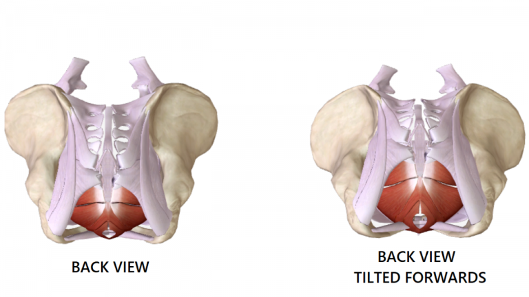 The Female Pelvis and Pelvic Alignment