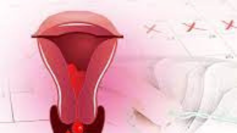 Common Menstrual Complaints