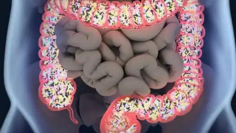 From Toxins to Trouble: The Vicious Cycle of Endotoxemia and Leaky Gut