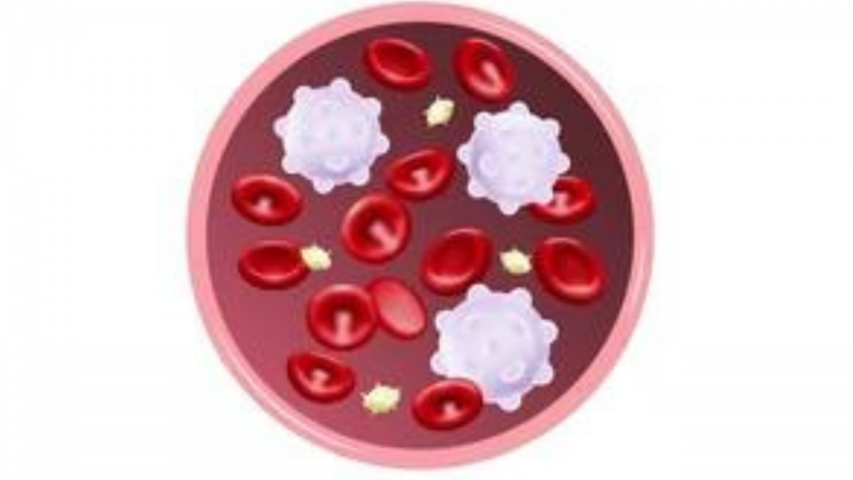 “Comprehensive Guide to Natural Approaches for Thalassemia Management”