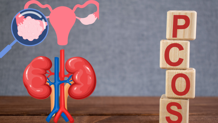 PCOS and Kidney Health: Understanding the Connection and How to Protect Your Kidneys